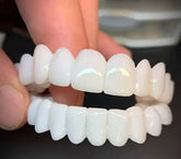 Dental White® Lens - Upper + Lower Kit (100% ADJUSTABLE TO ALL DENTAL ARCHES)