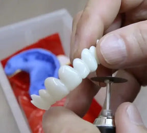 Dental White® Lens Upper + Lower Kit (100% ADJUSTABLE TO ALL DENTAL ARCHES)